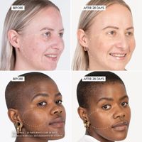 SKOON. HYDROSURGE Duo Pack – NanoPillow Serum + Activator Mist